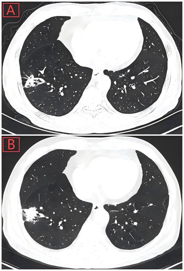 https://cdn.ncbi.nlm.nih.gov/pmc/blobs/61f5/12183169/72a8a59461bd/fonc-15-1605846-g001.jpg