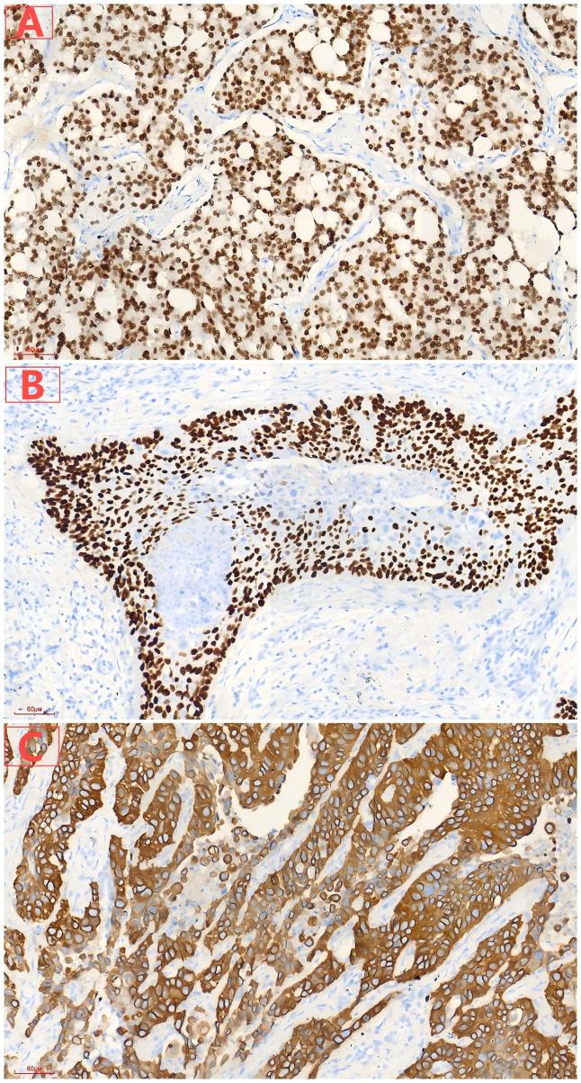 https://cdn.ncbi.nlm.nih.gov/pmc/blobs/61f5/12183169/d95579f258b5/fonc-15-1605846-g003.jpg