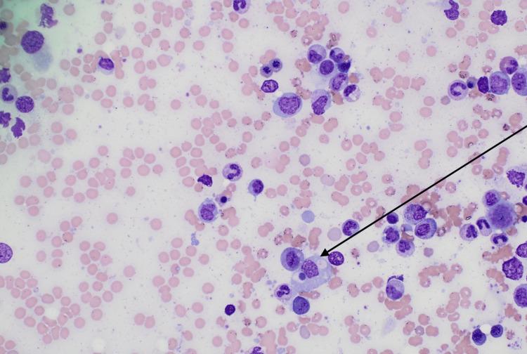 https://cdn.ncbi.nlm.nih.gov/pmc/blobs/61f6/12314013/12efde7a5ac7/cureus-0017-00000087066-i01.jpg