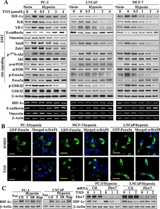 https://cdn.ncbi.nlm.nih.gov/pmc/blobs/61fa/4480751/d1c1ad044f04/oncotarget-06-8271-g003.jpg