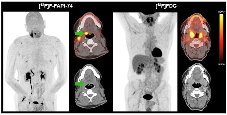 https://cdn.ncbi.nlm.nih.gov/pmc/blobs/6204/12249064/a50659e50bc7/cancers-17-02205-g001.jpg