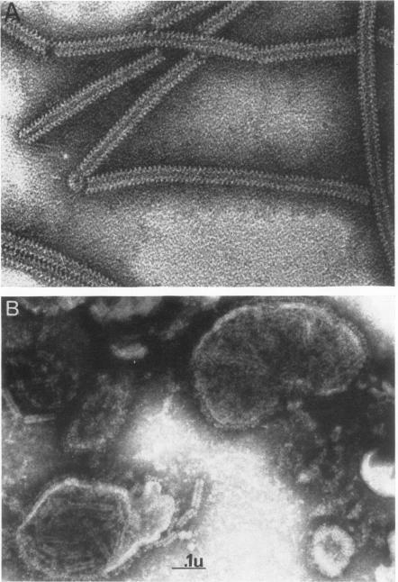 https://cdn.ncbi.nlm.nih.gov/pmc/blobs/6205/376051/ab27b5ed3487/jvirol00293-0104-a.jpg