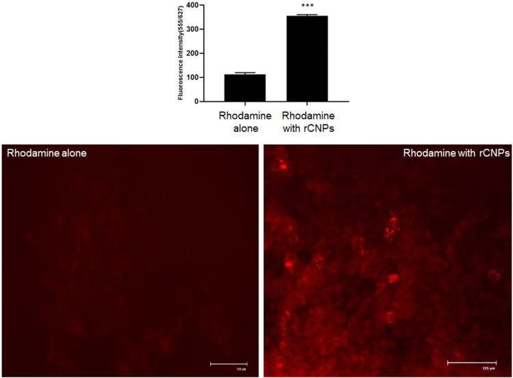 https://cdn.ncbi.nlm.nih.gov/pmc/blobs/620f/11110815/cb99426f503f/IJN-19-4465-g0011.jpg