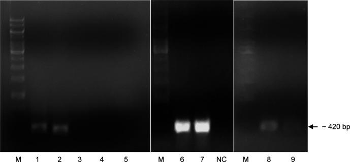 https://cdn.ncbi.nlm.nih.gov/pmc/blobs/6214/11240124/cc341f09e88d/f1000research-12-156535-g0000.jpg