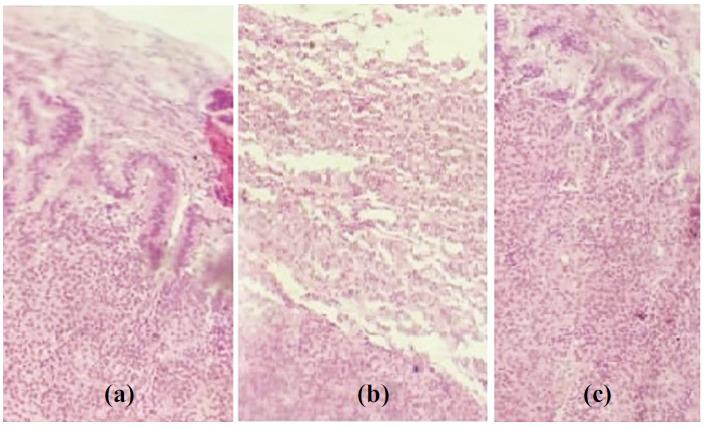 https://cdn.ncbi.nlm.nih.gov/pmc/blobs/6214/7040519/815f92559360/PNT-7-314_F6.jpg