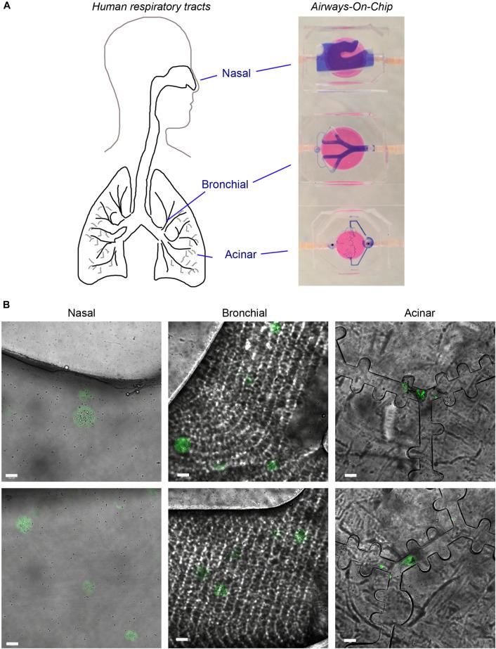 https://cdn.ncbi.nlm.nih.gov/pmc/blobs/6216/9395737/e561c16c7df3/fbioe-10-905557-g006.jpg