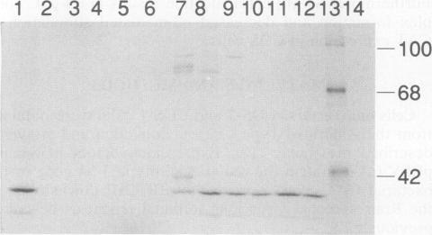 https://cdn.ncbi.nlm.nih.gov/pmc/blobs/621a/289010/5ad64f251094/jvirol00166-0368-b.jpg
