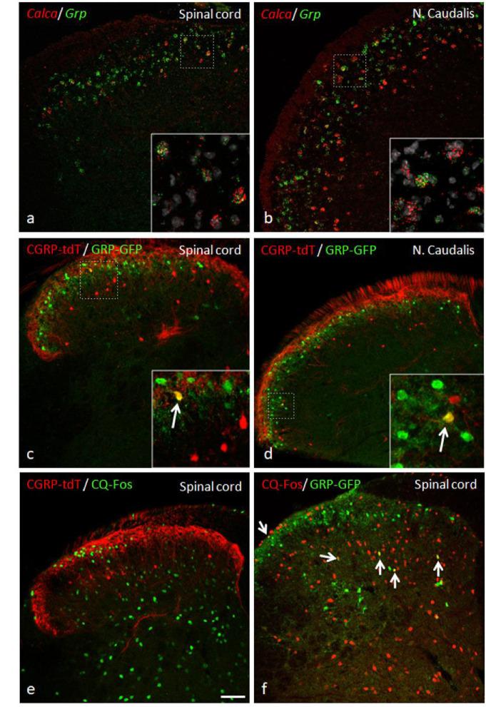 https://cdn.ncbi.nlm.nih.gov/pmc/blobs/621c/8245130/f3ba93cf2c4c/elife-59751-fig11.jpg