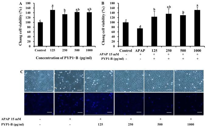 https://cdn.ncbi.nlm.nih.gov/pmc/blobs/621f/4501640/b423bf5d7c27/IJMM-36-02-0369-g05.jpg