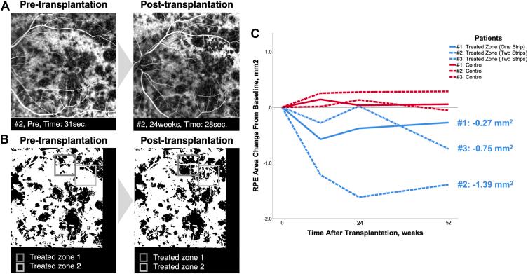 https://cdn.ncbi.nlm.nih.gov/pmc/blobs/6226/12036055/6278a2168c62/gr2.jpg