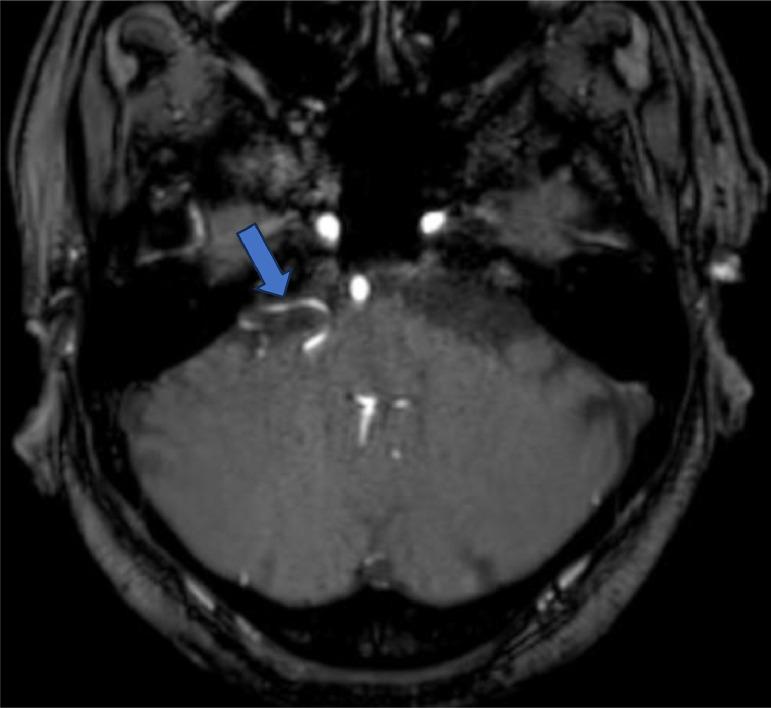 https://cdn.ncbi.nlm.nih.gov/pmc/blobs/6229/12136876/300bc70788ab/gr4.jpg