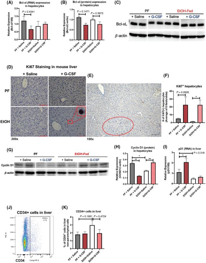 https://cdn.ncbi.nlm.nih.gov/pmc/blobs/6229/9426408/4611875921bf/HEP4-6-2322-g004.jpg