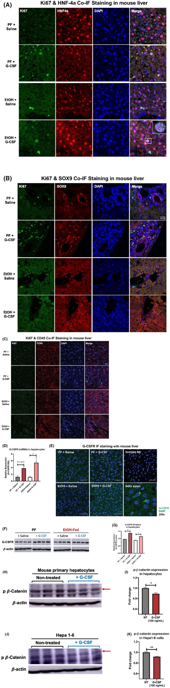 https://cdn.ncbi.nlm.nih.gov/pmc/blobs/6229/9426408/614afd38946e/HEP4-6-2322-g007.jpg