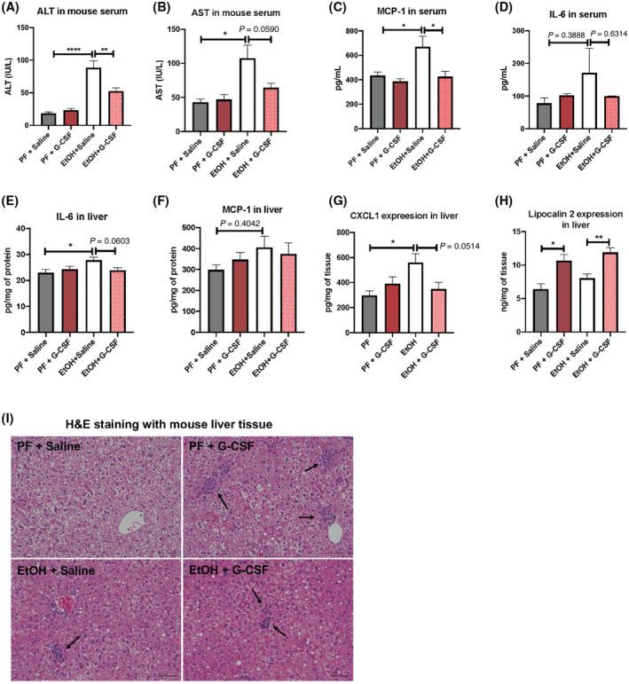 https://cdn.ncbi.nlm.nih.gov/pmc/blobs/6229/9426408/7e77502054fb/HEP4-6-2322-g002.jpg