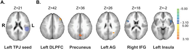 https://cdn.ncbi.nlm.nih.gov/pmc/blobs/622b/4753593/040ca7d5f28a/schbul_sbv114_f0001.jpg