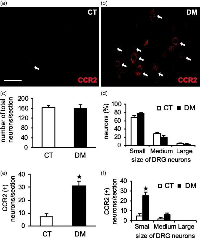 https://cdn.ncbi.nlm.nih.gov/pmc/blobs/622e/5784547/92bb0e064b0f/10.1177_1744806917751322-fig5.jpg