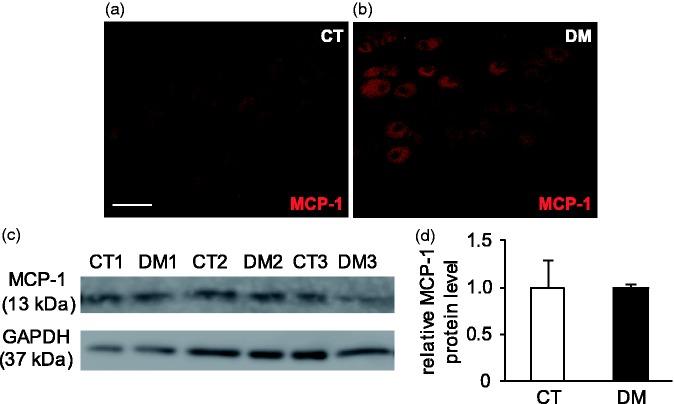 https://cdn.ncbi.nlm.nih.gov/pmc/blobs/622e/5784547/945723328619/10.1177_1744806917751322-fig7.jpg