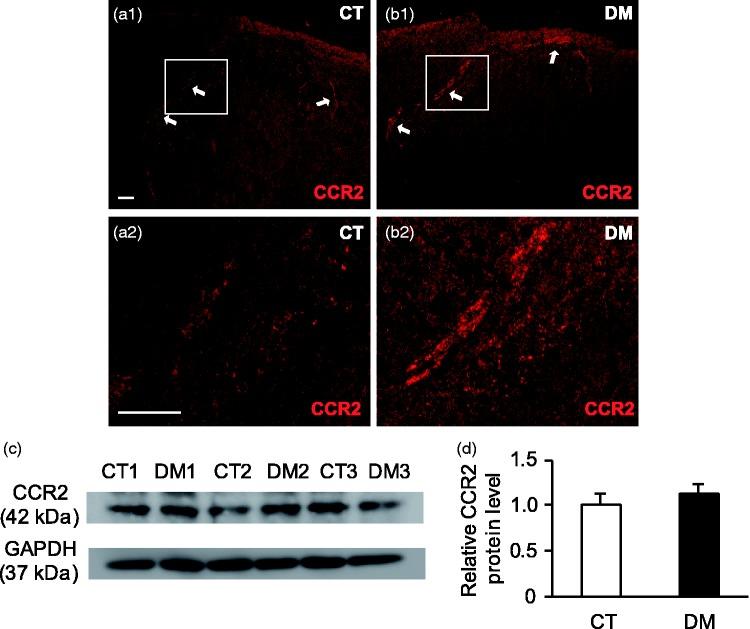 https://cdn.ncbi.nlm.nih.gov/pmc/blobs/622e/5784547/b00fe549a52e/10.1177_1744806917751322-fig6.jpg