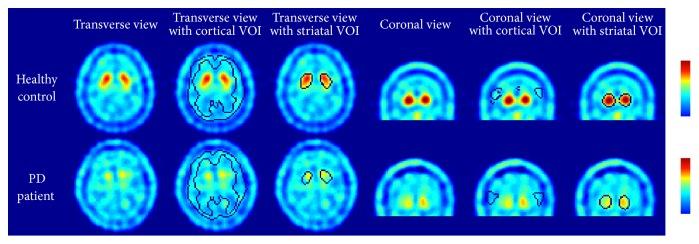https://cdn.ncbi.nlm.nih.gov/pmc/blobs/6231/4558437/44cfe903aa33/BMRI2015-461625.003.jpg