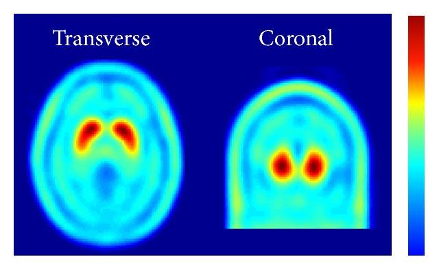 https://cdn.ncbi.nlm.nih.gov/pmc/blobs/6231/4558437/f903112212eb/BMRI2015-461625.001.jpg