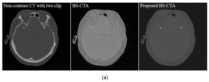 https://cdn.ncbi.nlm.nih.gov/pmc/blobs/6236/8871085/b3f343606628/diagnostics-12-00338-g007a.jpg