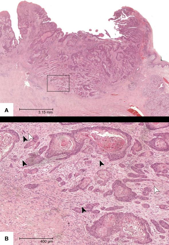 https://cdn.ncbi.nlm.nih.gov/pmc/blobs/623e/11089200/d8e20077713f/fonc-14-1404361-g002.jpg