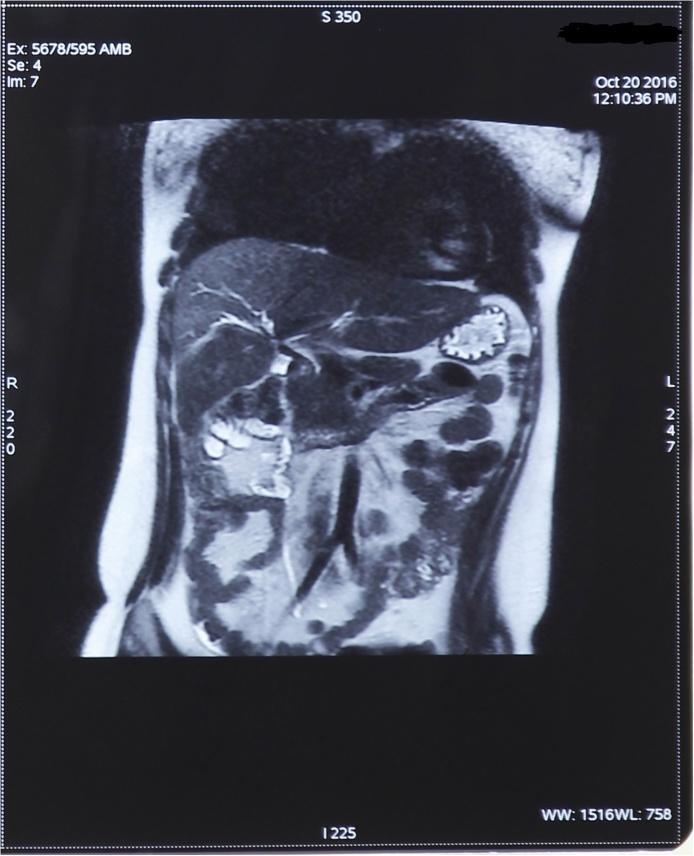 https://cdn.ncbi.nlm.nih.gov/pmc/blobs/6244/6041202/8093e5a71ccb/gr3.jpg