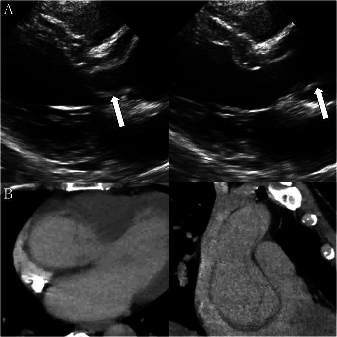 https://cdn.ncbi.nlm.nih.gov/pmc/blobs/6248/11687158/7e93f29fc5ba/13019_2024_3228_Fig1_HTML.jpg