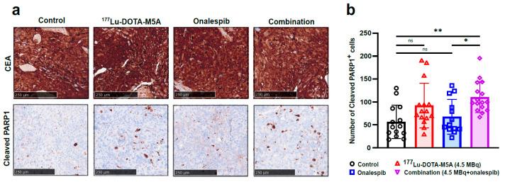 https://cdn.ncbi.nlm.nih.gov/pmc/blobs/624f/10486833/6d3ffba55d58/cancers-15-04239-g004.jpg