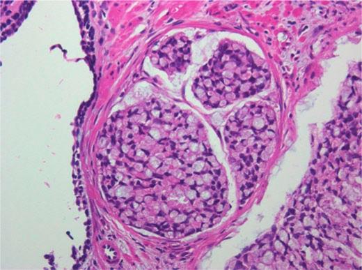 https://cdn.ncbi.nlm.nih.gov/pmc/blobs/6252/3220913/927b19602214/cro0004-0517-f02.jpg