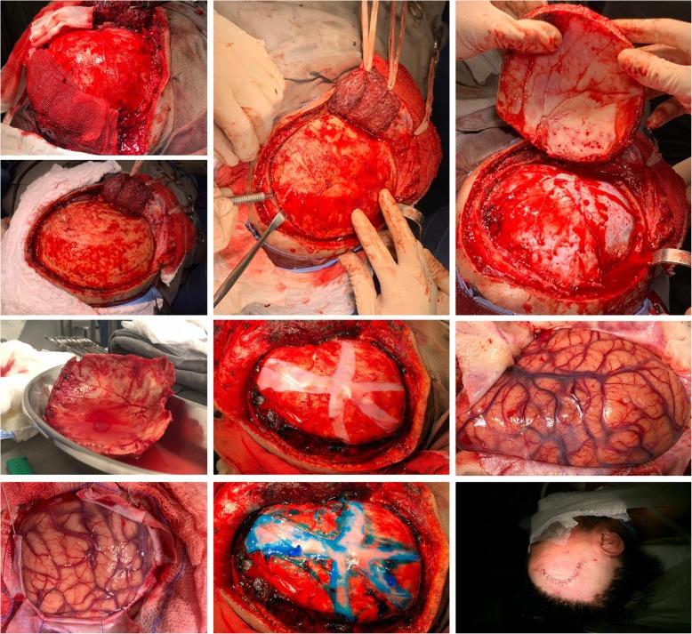 https://cdn.ncbi.nlm.nih.gov/pmc/blobs/6252/7006102/23197ec7b858/13054_2020_2749_Fig4_HTML.jpg