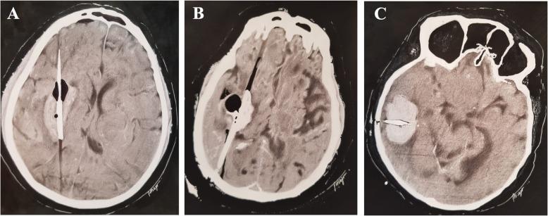 https://cdn.ncbi.nlm.nih.gov/pmc/blobs/6252/7006102/96979982d6bc/13054_2020_2749_Fig5_HTML.jpg