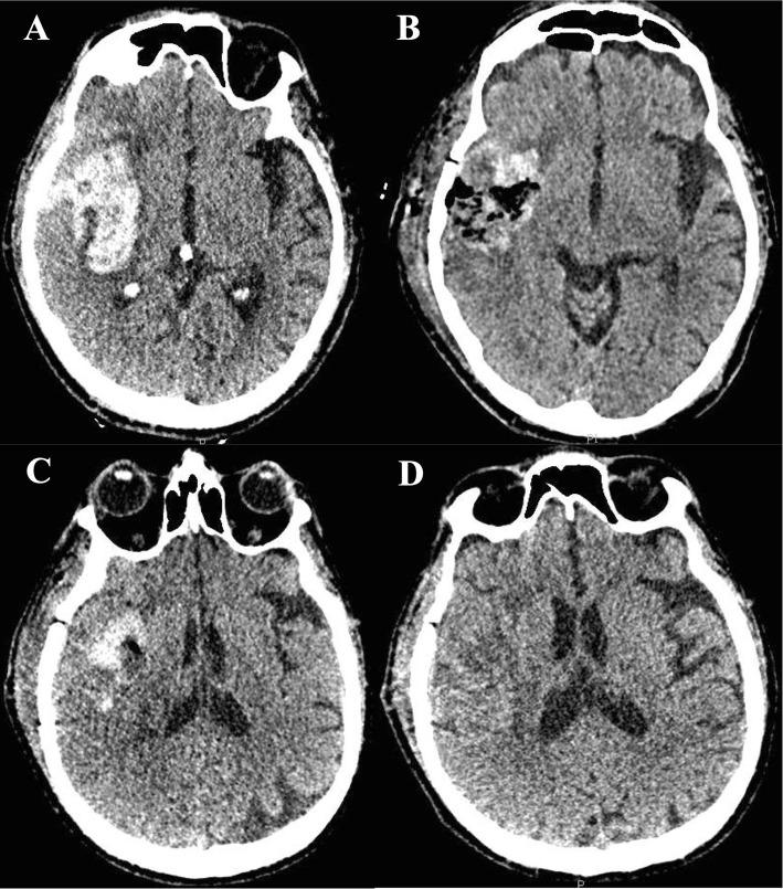 https://cdn.ncbi.nlm.nih.gov/pmc/blobs/6252/7006102/aa2b2ed717e5/13054_2020_2749_Fig2_HTML.jpg