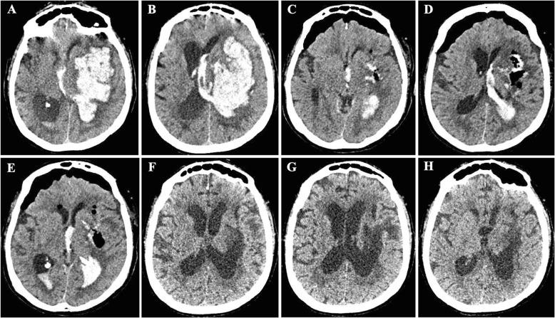https://cdn.ncbi.nlm.nih.gov/pmc/blobs/6252/7006102/ff6c0a818fab/13054_2020_2749_Fig3_HTML.jpg