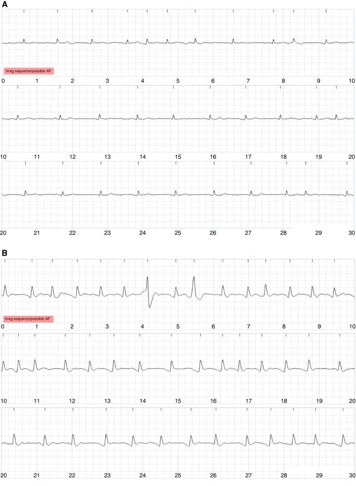 https://cdn.ncbi.nlm.nih.gov/pmc/blobs/6256/11249076/b9585d12a861/euae181f4.jpg