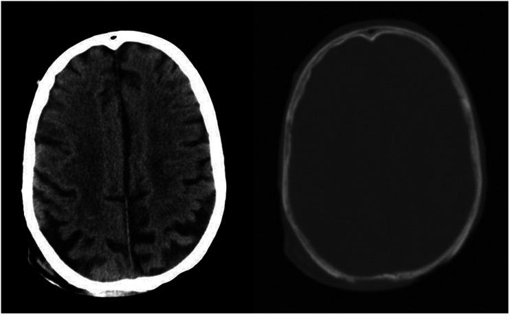 https://cdn.ncbi.nlm.nih.gov/pmc/blobs/6256/8649184/1e5a5bb8064a/10.1177_19714009211017777-fig1.jpg