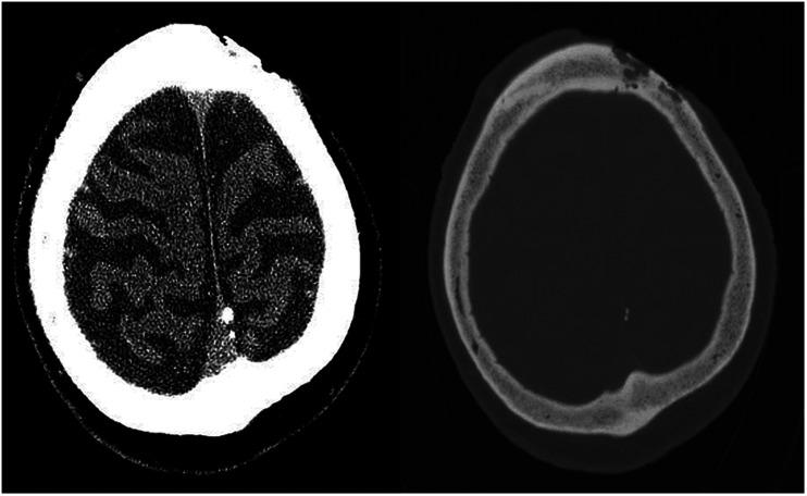 https://cdn.ncbi.nlm.nih.gov/pmc/blobs/6256/8649184/39c6b1c6cbc5/10.1177_19714009211017777-fig2.jpg