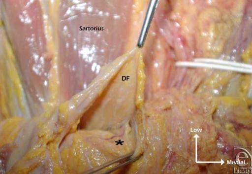 https://cdn.ncbi.nlm.nih.gov/pmc/blobs/6257/2808053/285674b435d5/eplasty10e11_fig7.jpg