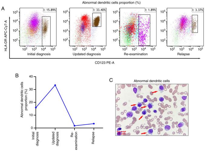 https://cdn.ncbi.nlm.nih.gov/pmc/blobs/6258/12319271/b1a80314461a/ol-30-04-15202-g03.jpg