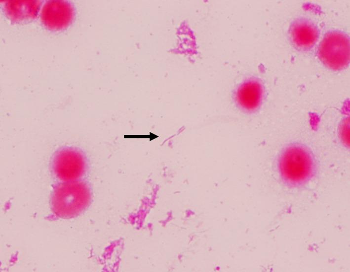 https://cdn.ncbi.nlm.nih.gov/pmc/blobs/6258/8857961/4d9ac8d6c32c/AMS2-9-e738-g002.jpg