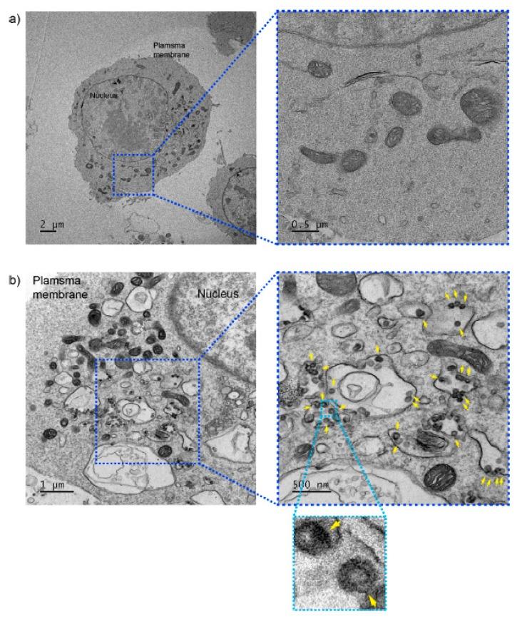 https://cdn.ncbi.nlm.nih.gov/pmc/blobs/625c/6928719/c779abd0e677/ijms-20-05850-g005.jpg