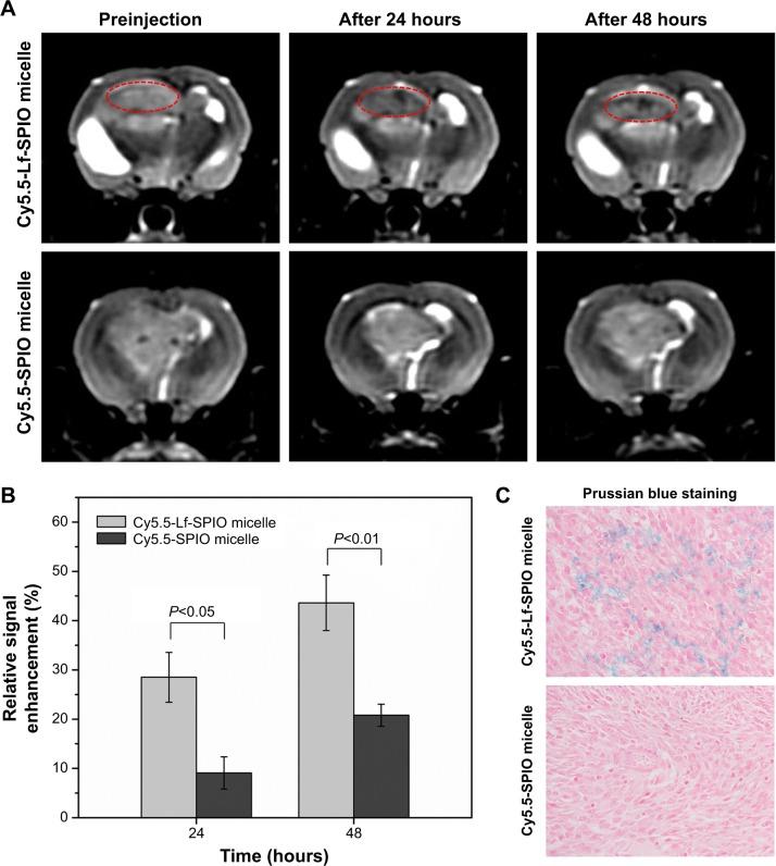 https://cdn.ncbi.nlm.nih.gov/pmc/blobs/6263/4356700/7a3e07463b14/ijn-10-1805Fig6.jpg