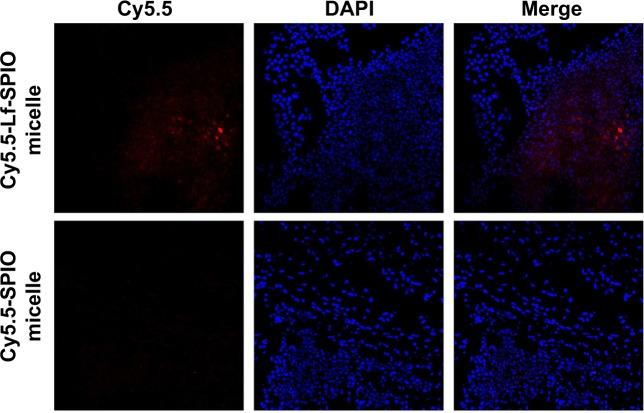 https://cdn.ncbi.nlm.nih.gov/pmc/blobs/6263/4356700/7ba7342620a7/ijn-10-1805Fig8.jpg