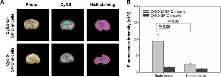 https://cdn.ncbi.nlm.nih.gov/pmc/blobs/6263/4356700/bb5877c32ce4/ijn-10-1805Fig7.jpg