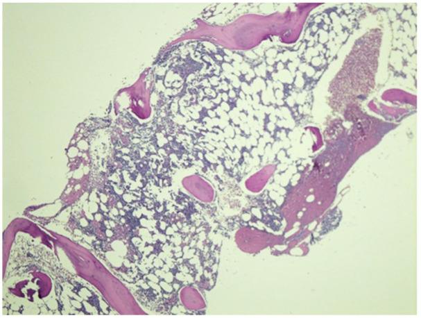 https://cdn.ncbi.nlm.nih.gov/pmc/blobs/6268/9125062/8fef27f857a9/10.1177_23247096221097523-fig1.jpg
