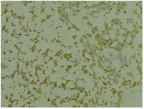 https://cdn.ncbi.nlm.nih.gov/pmc/blobs/6268/9125062/eb4549b4a665/10.1177_23247096221097523-fig3.jpg