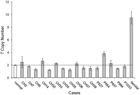 https://cdn.ncbi.nlm.nih.gov/pmc/blobs/6269/3094331/ae4474b1b5b3/pone.0018846.g006.jpg
