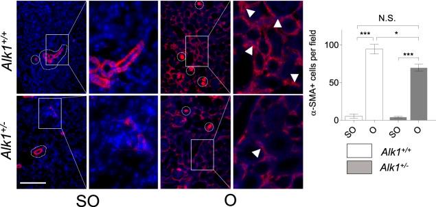 https://cdn.ncbi.nlm.nih.gov/pmc/blobs/626b/9234496/e9f99964682b/fphar-13-843732-g005.jpg