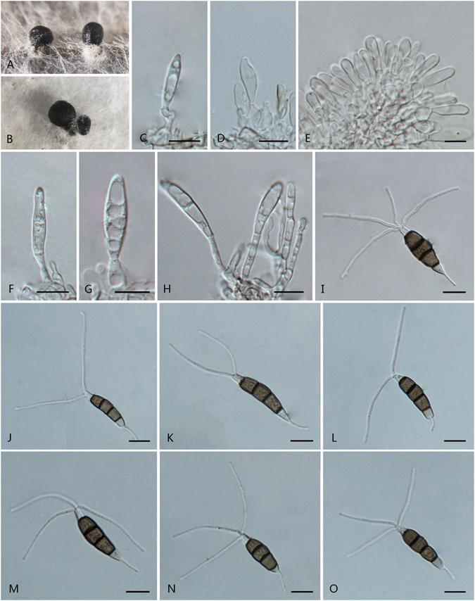 https://cdn.ncbi.nlm.nih.gov/pmc/blobs/627c/5429834/59a6c74d848e/41598_2017_972_Fig15_HTML.jpg