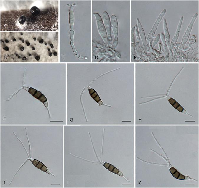 https://cdn.ncbi.nlm.nih.gov/pmc/blobs/627c/5429834/b315a86715a9/41598_2017_972_Fig16_HTML.jpg
